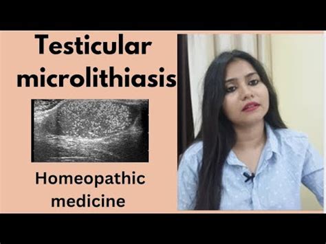 Testicular microlithiasis Homeopathic treatment !!Testicular lithiasis symptoms,causes ...