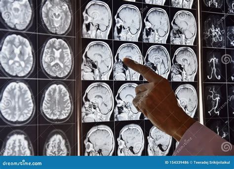 View 26 Brain Anatomy Mri Radiology - blablawasung