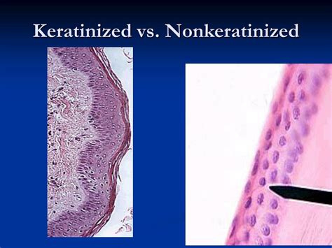 Keratinized Vs Non Keratinized Stratified Squamous Epithelium Images ...