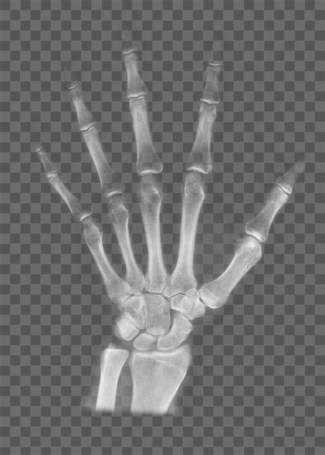 Free: Hand CT scan png sticker, | Free PNG - rawpixel - nohat.cc