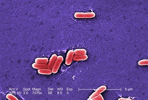 Imagen gratis: coli, O157, infección grave con sangre, diarrea, dolor abdominal, calambres