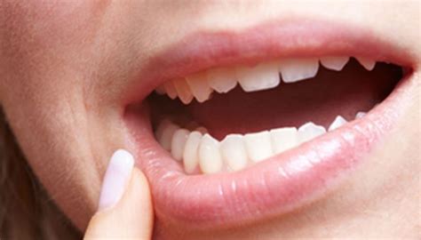 ¿Por qué se mueven los dientes? | Odontotecks