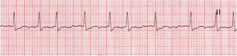 Pin on Cardiac images