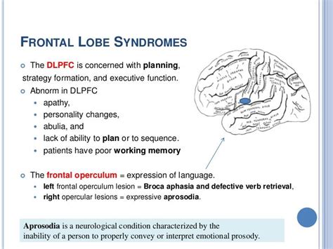 Pin by Lujain Jumran on Brain anatomy | Brain anatomy, Frontal lobe ...