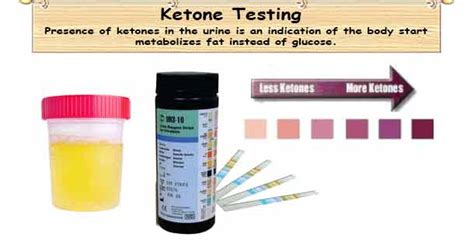 Ketone Test Strip | Ketone Test | Ketosis Test | Urine Test Diabetes