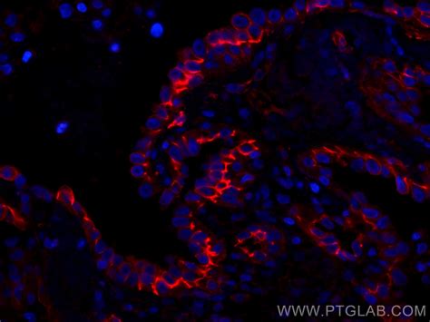 CD44 antibody (CL594-60224) | Proteintech