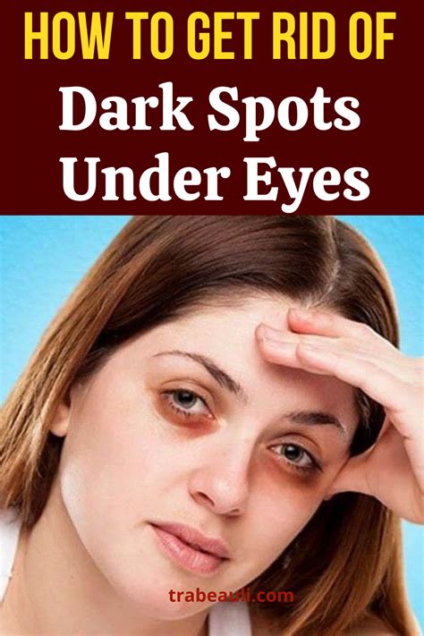 Read about how to get rid of dark spots under eyes at home. We have listed natural home remedies ...