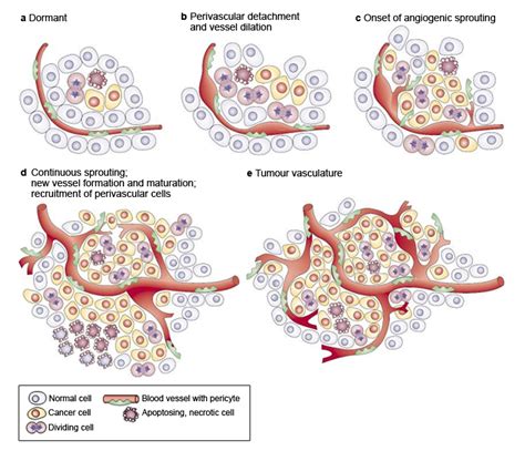 FIGURE 2. The Angiogenic Switch and Tumor Neovascularization