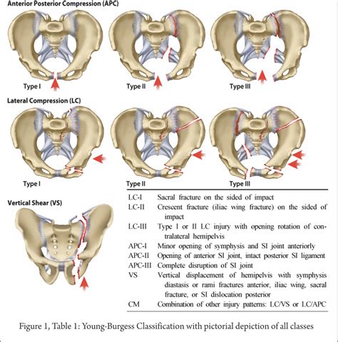 Hip fractures - complication - salvage procedure - therapeutic algorithm Archives - Trauma ...