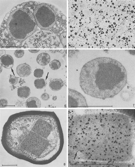 Peroxisome Electron Micrograph