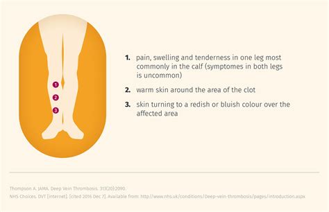 Signs and Symptoms DVT | Thrombosis Adviser