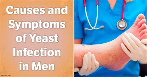 Causes and Symptoms of Yeast Infection in Men