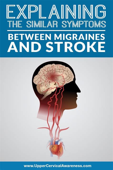 Explaining the Similar Symptoms Between Migraines and Stroke | Migraine ...