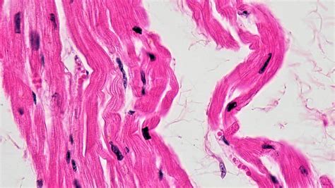 Muscle Tissue: Cardiac Muscle | cross section: cardiac muscl… | Flickr