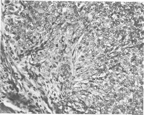 Figure 23 from The morphologic effects of synthetic reproductive steroids on the mammary gland ...