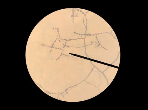 Geotrichum Spores, A Genus Of Fungi Found In The Air And Sewage Of Landfill, Using Microscope To ...