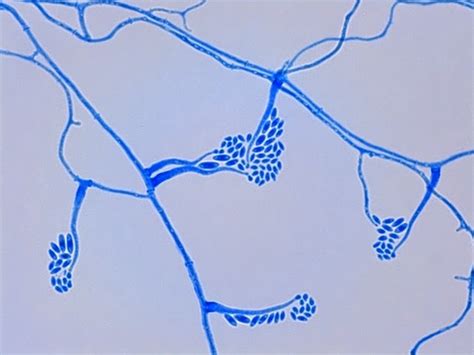 Fun With Microbiology (What's Buggin' You?): Acremonium species