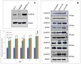 Leuprorelin Acetate Long-Lasting Effects on GnRH Receptors of Prostate Cancer Cells: An Atomic ...