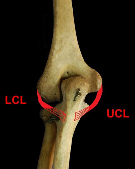 Analyzing Chicago Cubs Pitchers' Tommy John Surgery Risk