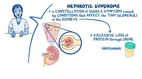 Nephrotic Syndrome Edema