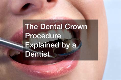 The Dental Crown Procedure Explained by a Dentist - Dental Magazine