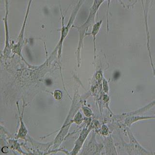 Morphology of cultured chondrons as seen with an inverted... | Download ...