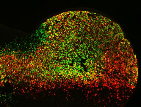 Gene Enhancers Are Important Despite Apparent Redundancy - Biosciences Area