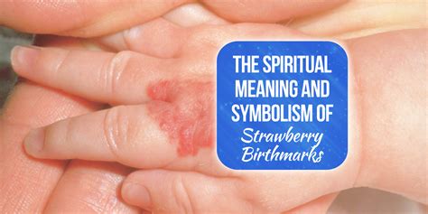 Strawberry Birthmark Spiritual Meaning [Learn The Special Meanings!] | Simply Symbolism