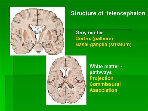 PPT - Telencephalon PowerPoint Presentation, free download - ID:9733356