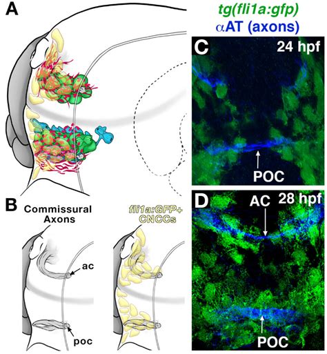 Forebrain Development - Barresi Lab