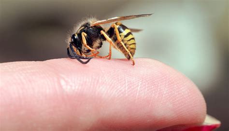 How dangerous are wasp stings? - The Wasp Experts Scotland