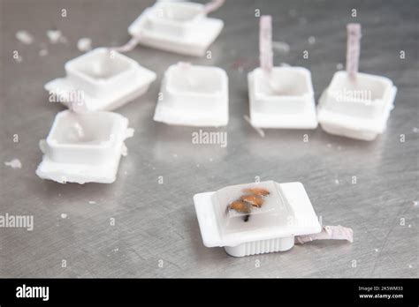 Paraffin blocks containing biopsy tissue for sectioning. Pathology ...