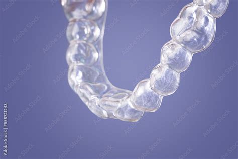 dental hygiene, orthodontic treatment, occlusal splint Stock Photo ...