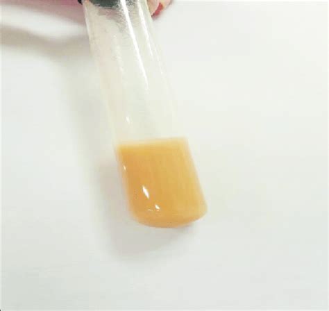 Cerebrospinal Fluid Color