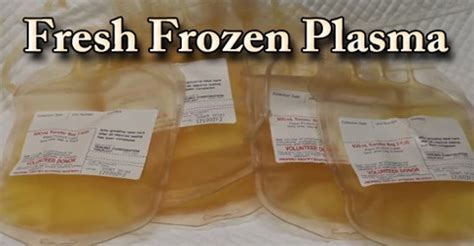 FFP: Fresh Frozen Plasma - Assignment Point