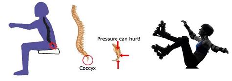 Tailbone Injury – Physicalguru.com