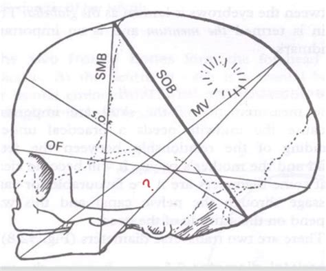 Diameter of fetal skull (diagram) Flashcards | Quizlet