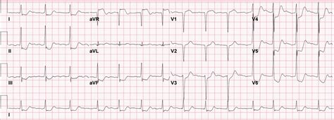 Dr. Smith's ECG Blog: February 2018