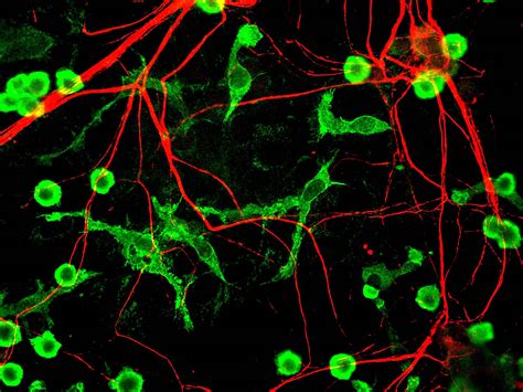 The missing subtype: exploring microglial diversity in aging and Alzheimer’s disease - 10x Genomics