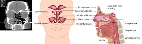 Sinus Surgery Center - Image Guided Sinus Surgery System