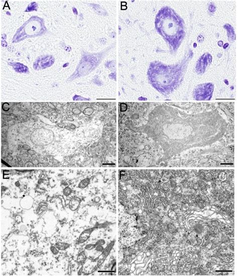 Chromatolysis in TDP-43M337V mice. Nissl staining of motor neurons of... | Download Scientific ...