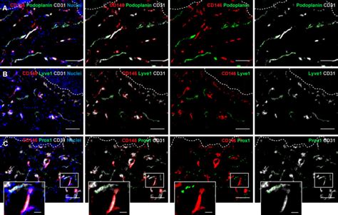 CD146 expression profile in human skin and pre-vascularized dermo-epidermal skin substitutes in ...