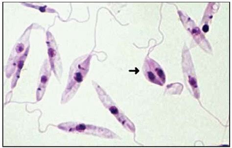 Leishmania tropica | Medical laboratory scientist, Medical laboratory ...