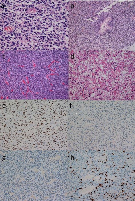 Photomicrographs showing the histological findings of the tumor tissue... | Download Scientific ...