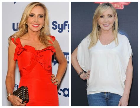 'Real Housewives of Orange County' Star Shannon Beador Sparks Plastic Surgery Rumors — See Her ...