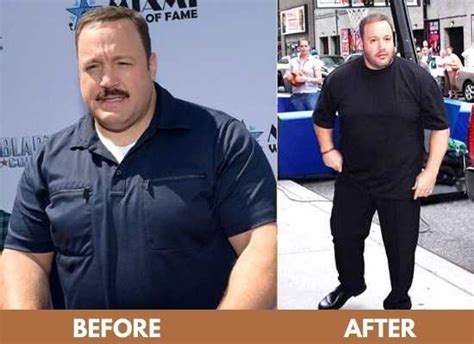 Kevin James Weight Loss 2024: Diet, Surgery, Before & After Photos