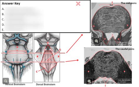 18.3.7 Ventral and Dorsal Brainstem Diagram | Quizlet