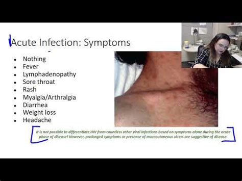 Hiv Infection Stages