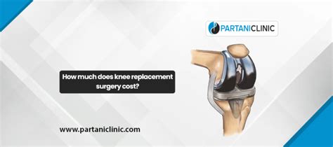 How much does knee replacement surgery cost in Jaipur?