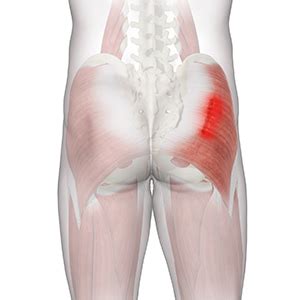 Gluteal Strain Treatment Southington | Hip Pain Treatment Wallingford, Meriden